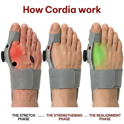 Cordia™ Calibrated Bunion Corrector